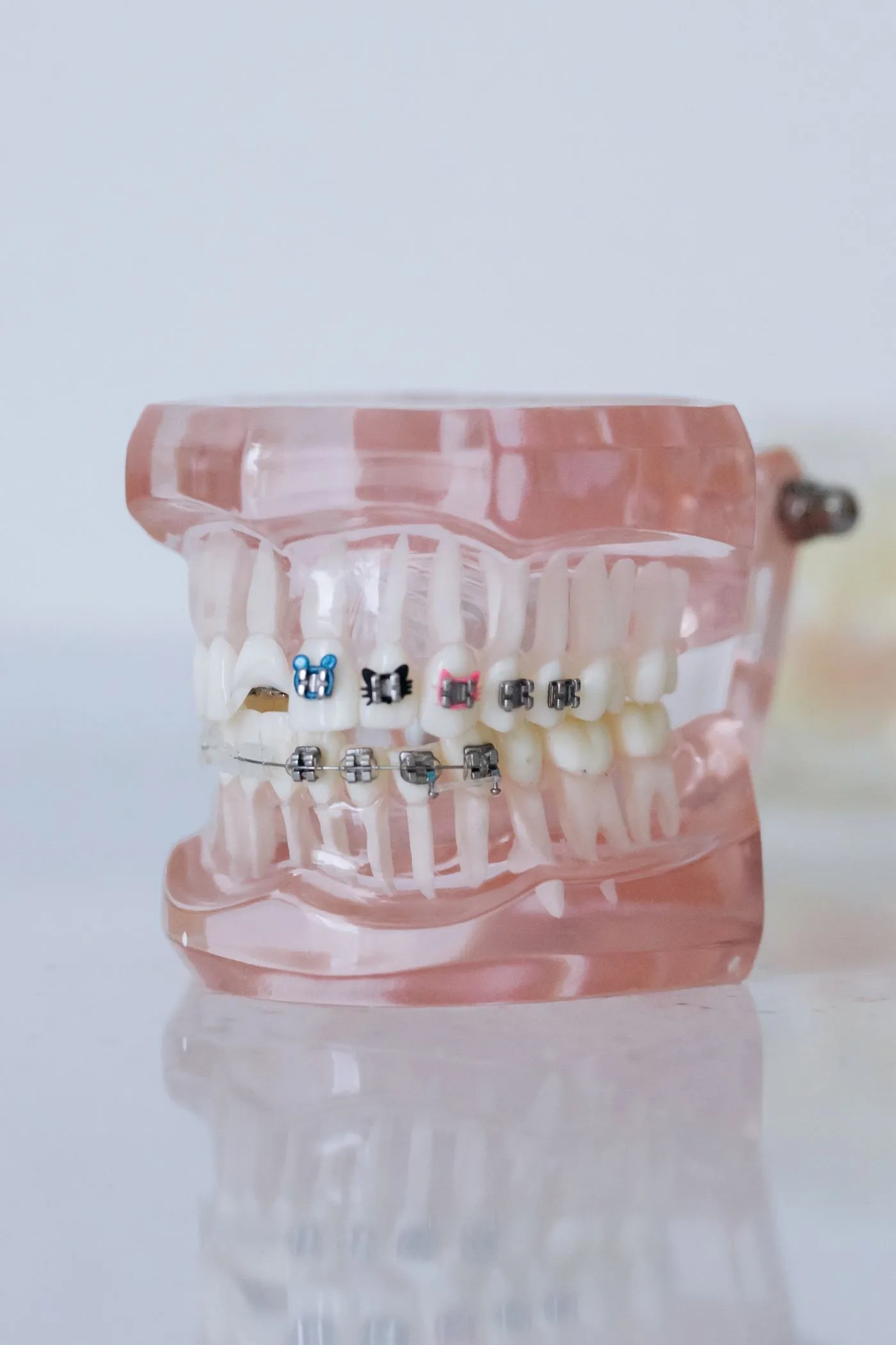 Modelo dental físico con brackets metálicos y ligas de colores